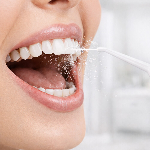 Процесс чистки зубов ирригатором stl di-m01.